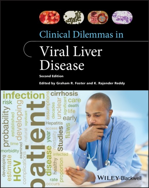 Clinical Dilemmas in Viral Liver Disease 2e