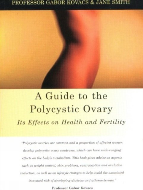 A Guide to the Polycystic Ovary