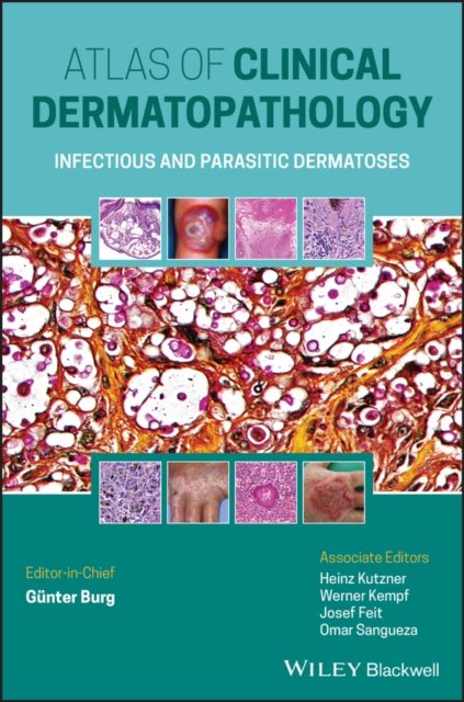 Atlas of Clinical Dermatopathology – Infectious and Parasitic Dermatoses