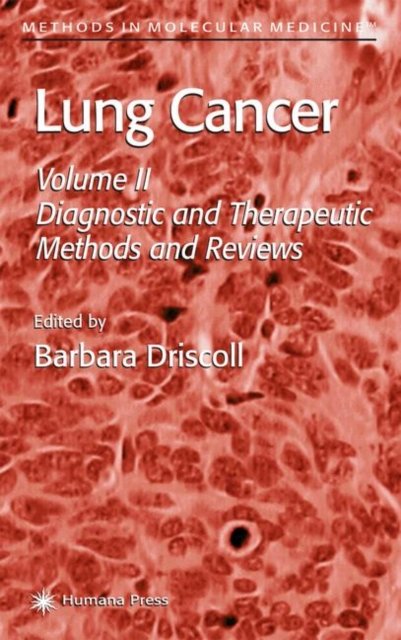 Lung Cancer
