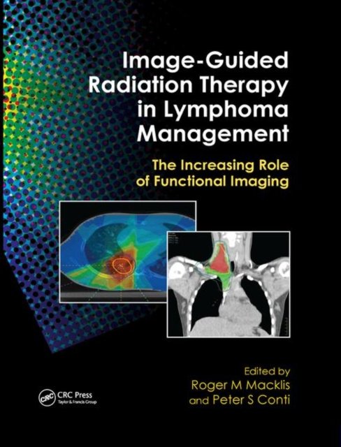 Image-guided Radiation Therapy in Lymphoma Management