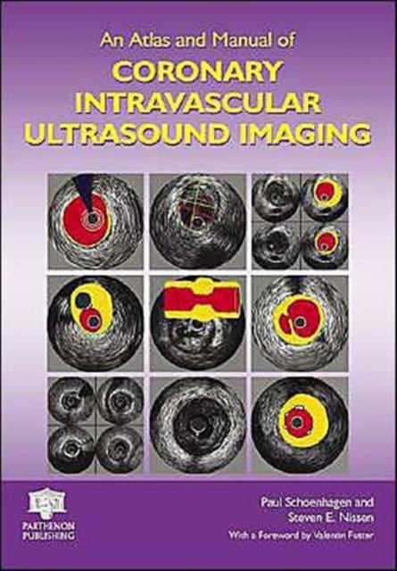 An Atlas and Manual of Coronary Intravascular Ultrasound Imaging