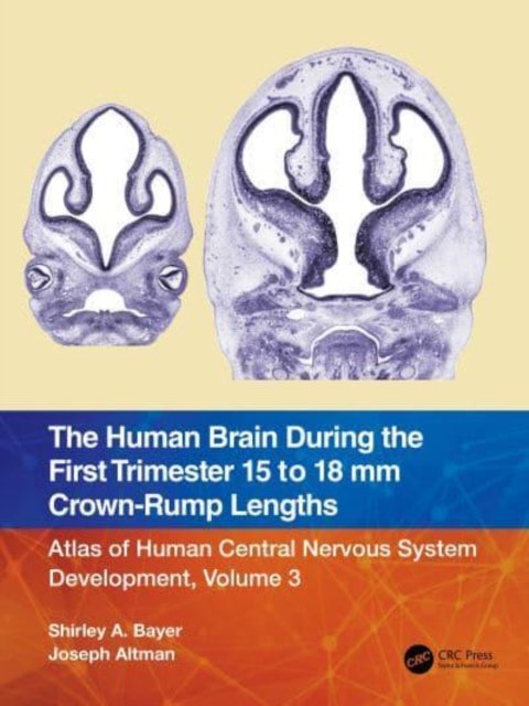 The Human Brain during the First Trimester 15- to 18-mm Crown-Rump Lengths