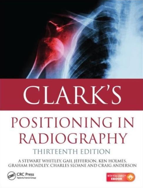 Clark''s Positioning in Radiography