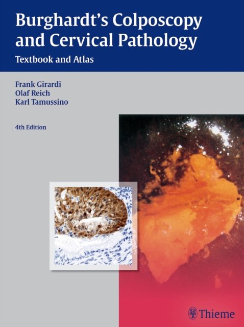 Burghardt''s Colposcopy and Cervical Pathology