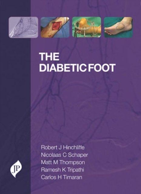 The Diabetic Foot