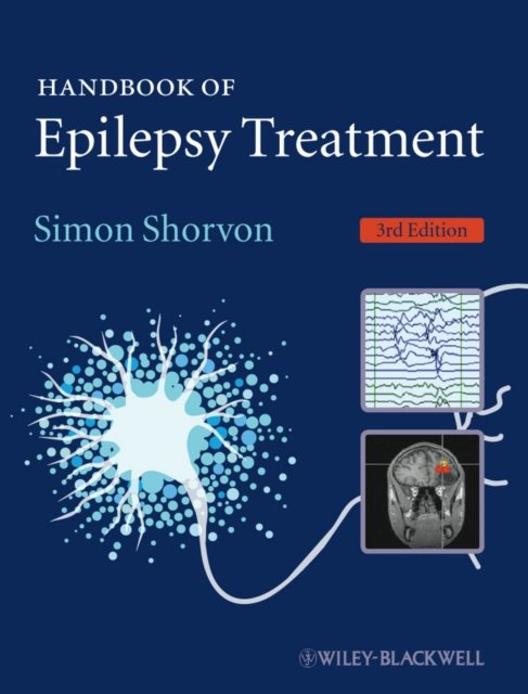 Handbook of Epilepsy Treatment 3e