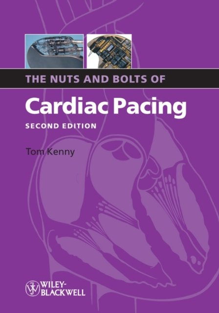 Nuts Bolts Cardiac Pacing 2e