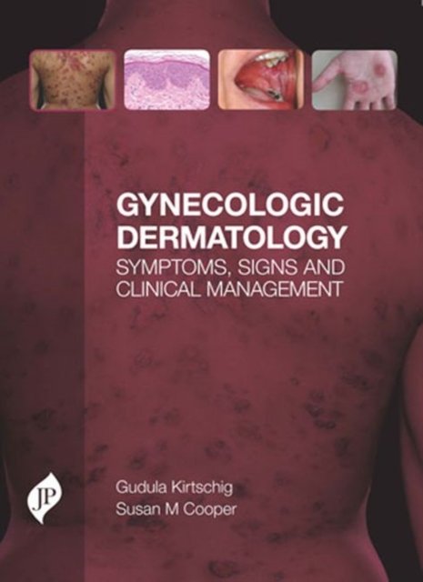 Gynecologic Dermatology