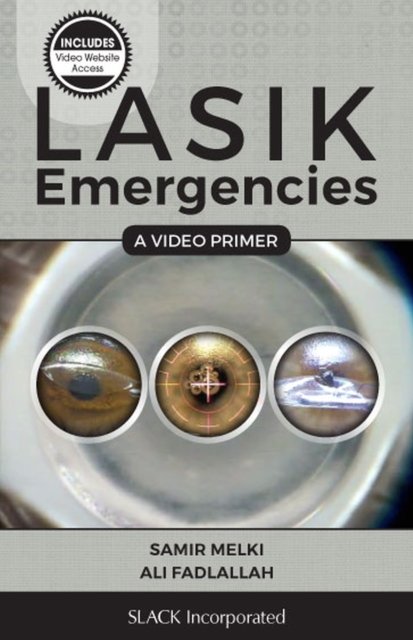 LASIK Emergencies: A Video Primer