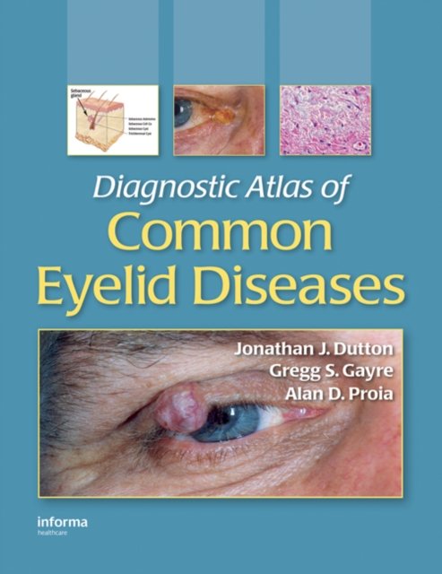 Diagnostic Atlas of Common Eyelid Diseases