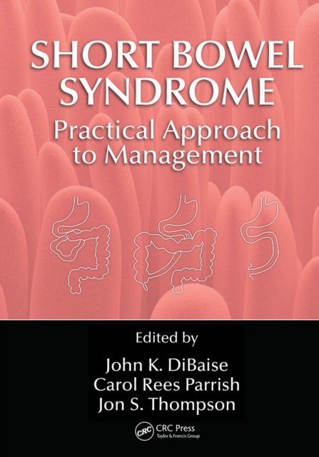 Short Bowel Syndrome
