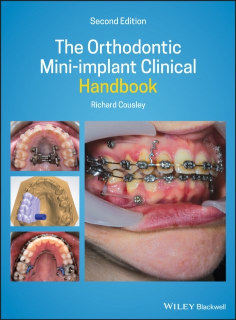 The Orthodontic Mini–implant Clinical Handbook 2nd  Edition
