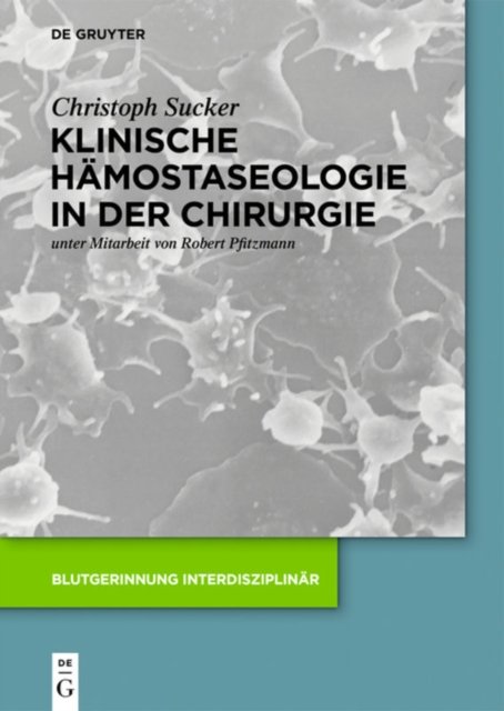 Klinische Hamostaseologie in der Chirurgie
