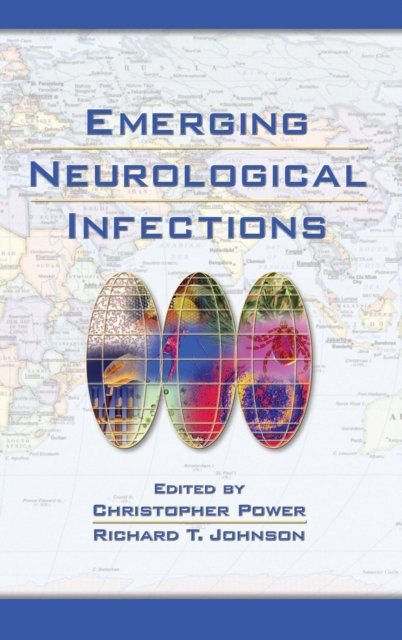 Emerging Neurological Infections