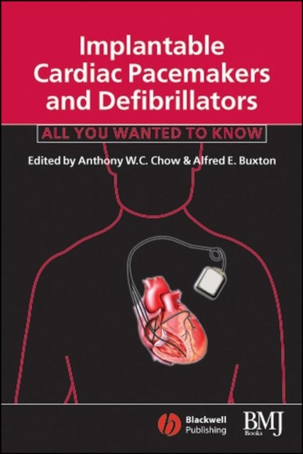 Implantable Cardiac Pacemakers and Defibrillators – All You Wanted to Know