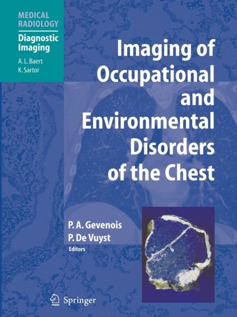 Imaging of Occupational and Environmental Disorders of the Chest