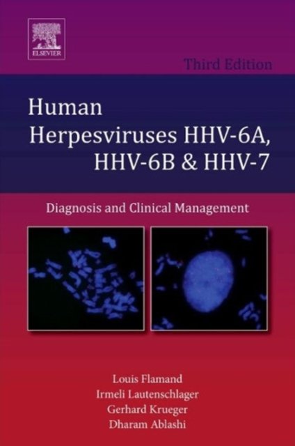 Human Herpesviruses HHV-6A, HHV-6B and HHV-7
