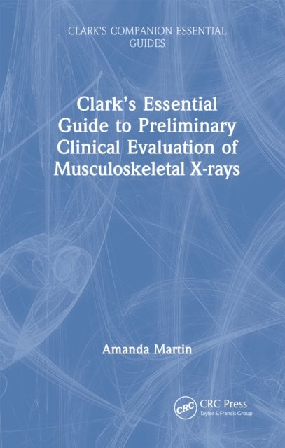 Clark?s Essential Guide to Preliminary Clinical Evaluation of Musculoskeletal X-rays