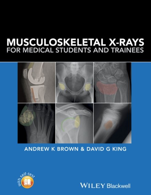 Musculoskeletal X–Rays for Medical Students and Trainees