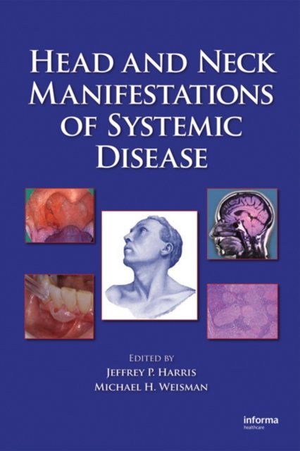Head and Neck Manifestations of Systemic Disease