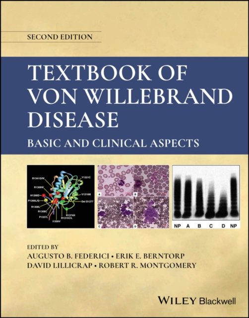 Textbook of von Willebrand Disease – Basic and Clinical Aspects, 2nd Edition