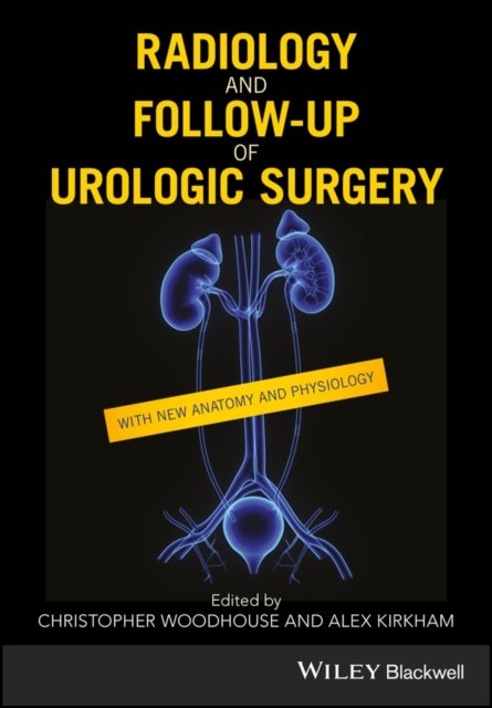 Radiology and Follow–up of Urologic Surgery