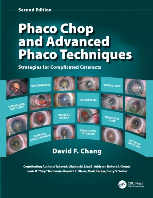 Phaco Chop and Advanced Phaco Techniques