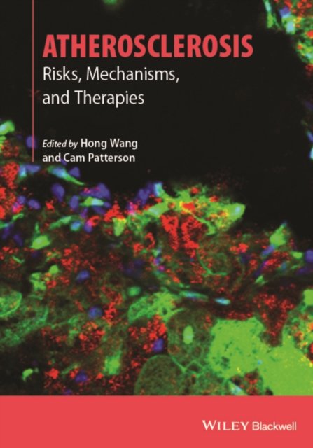 Atherosclerosis – Risks, Mechanisms and Therapies