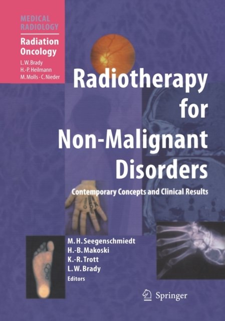 Radiotherapy for Non-Malignant Disorders