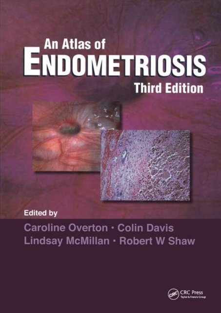 An Atlas of Endometriosis