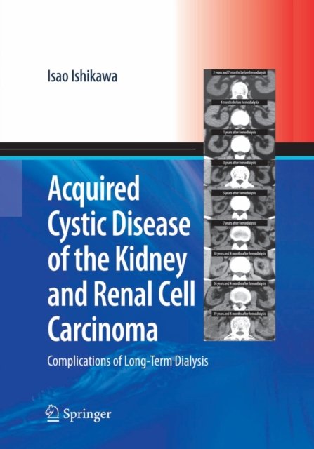 Acquired Cystic Disease of the Kidney and Renal Cell Carcinoma