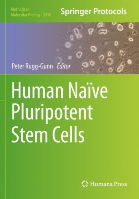 Human Naive Pluripotent Stem Cells