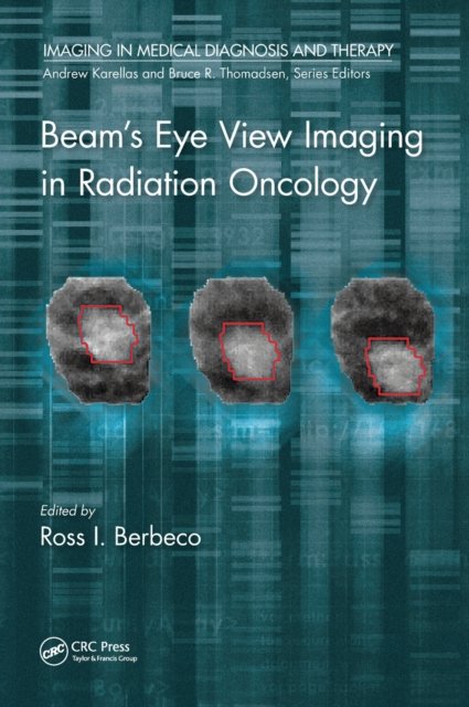 Beam''s Eye View Imaging in Radiation Oncology
