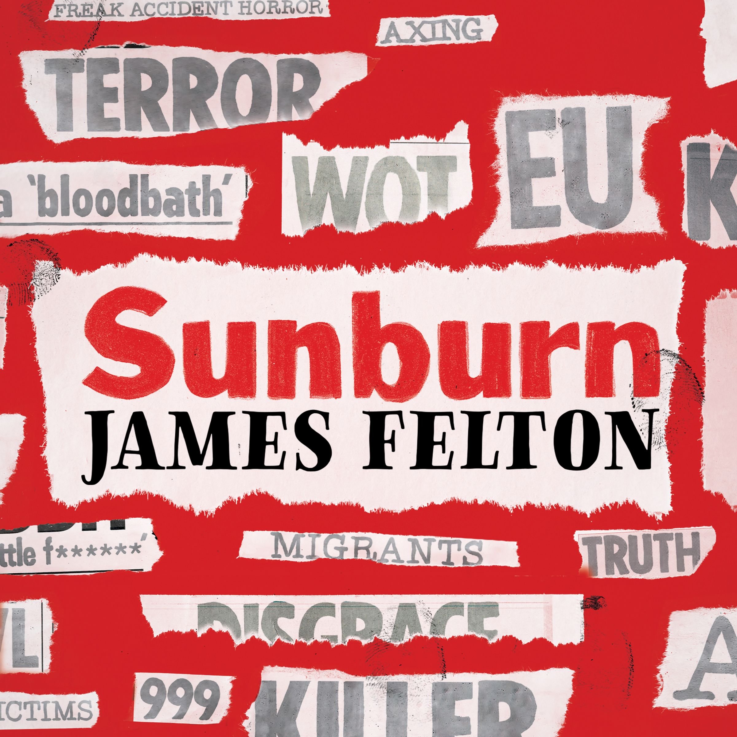Sunburn