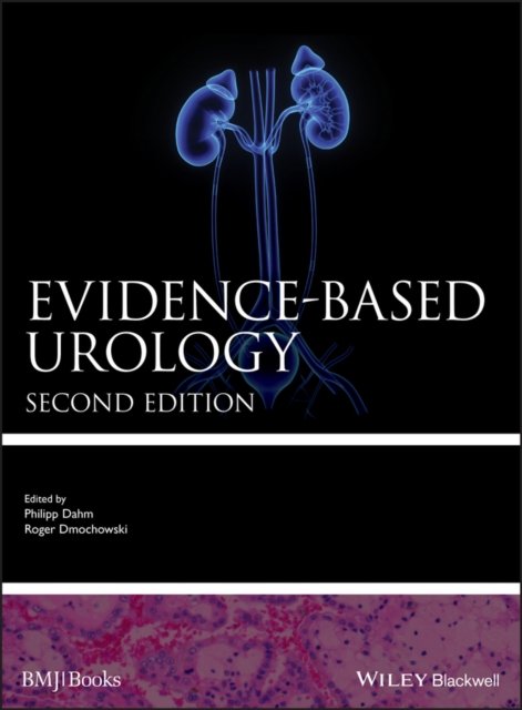 Evidence–based Urology 2e
