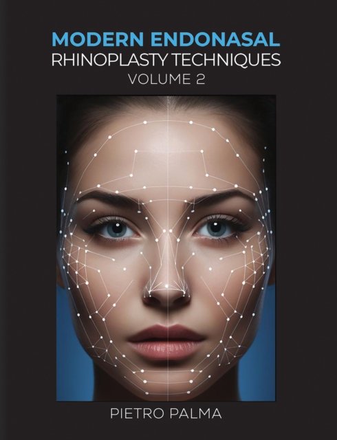 Modern Endonasal Rhinoplasty Techniques – Volume 2
