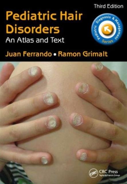 Pediatric Hair Disorders