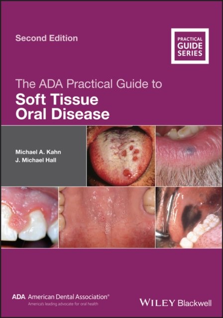 The ADA Practical Guide to Soft Tissue Oral Disease 2e