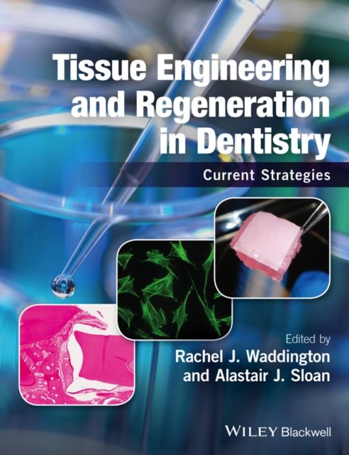 Tissue Engineering and Regeneration in Dentistry – Current Strategies