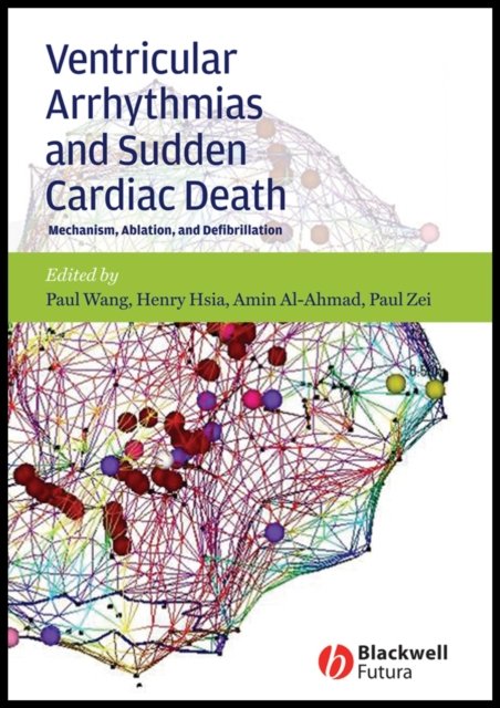 Ventricular Arrhythmias and Sudden Cardiac Death