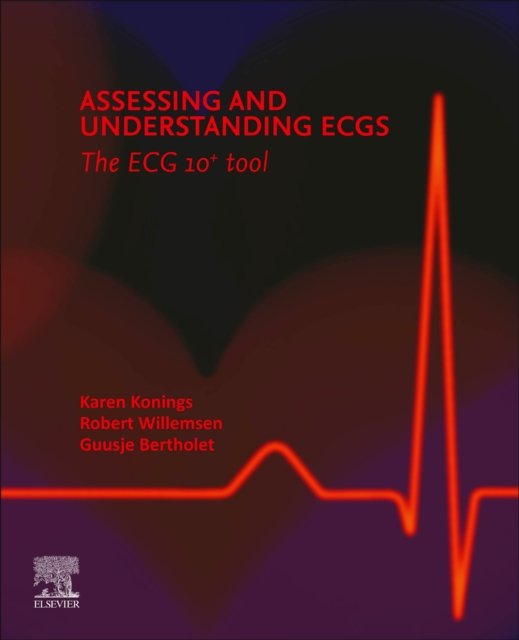 Assessing and Understanding ECGs: The ECG10+ tool