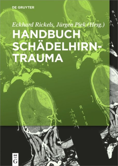 Handbuch Schadelhirntrauma