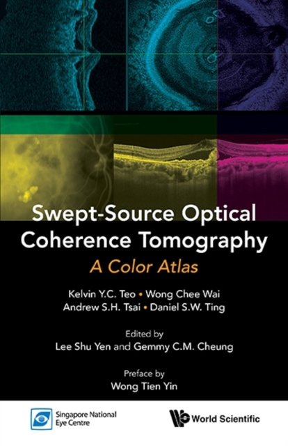 SWEPT-SOURCE OPTICAL COHERENCE TOMOGRAPHY