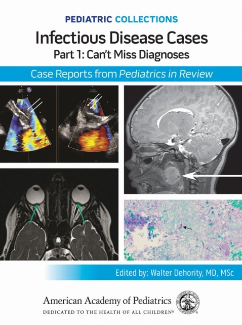 Infectious Disease Cases: Part 1: Can't Miss Diagnoses