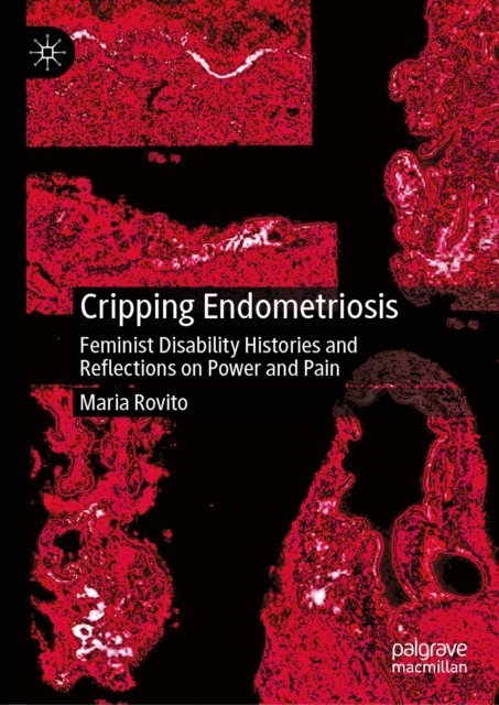 Cripping Endometriosis