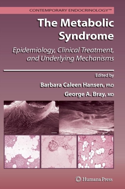 The Metabolic Syndrome: