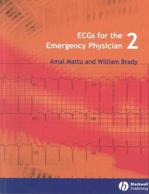 ECGs for the Emergency Physici