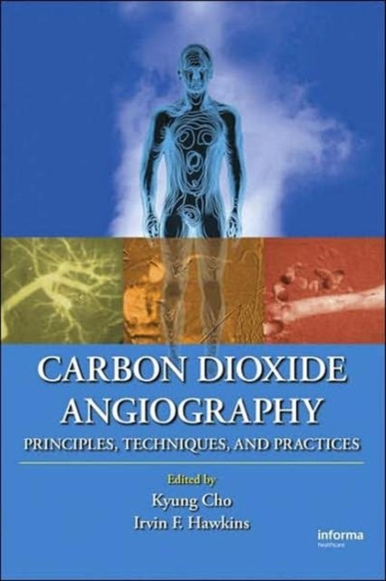 Carbon Dioxide Angiography