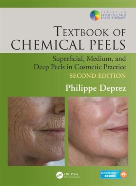 Textbook of Chemical Peels